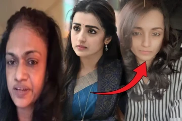 நடிகை த்ரிஷாவிற்கு முகமெல்லாம் ஒட்டிபோக என்ன காரணம்? பாடகி சுசித்ரா விளக்கம்