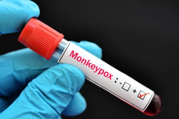 குரங்கம்மையின் பெயர் மாற்றம்!