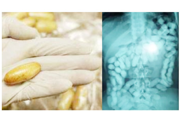 விமான நிலையத்தில் சிக்கிய நபர் - வயிற்றை சோதனை போட்ட போது அதிர்ச்சி அடைந்த அதிகாரிகள் | World Viral News