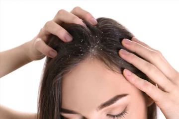 பொடுகு பிரச்சினையை  அடியோடு விரட்ட இதோ சில அசத்தலான டிப்ஸ்.. உங்களுக்காக!