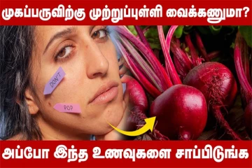 அதிக முகப்பருவால் அவஸ்தையா? இதை ட்ரை பண்ணுங்க போதும்!