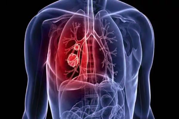 நுரையீரலை சுத்தம் செய்ய - சுவாமி ராம் தேவ் கூறும் 