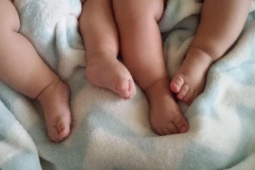 2 தலை, 1 இதயம்... ஒட்டி பிறந்த இரட்டைக் குழந்தைகள்... இந்தியாவில் அரிய சம்பவம்