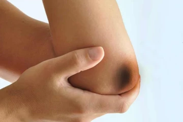 உங்கள் கை முட்டி பகுதிகளில் ஏற்படும் கருமையை போக்க வேண்டுமா? இதோ சில சூப்பரான டிப்ஸ்!