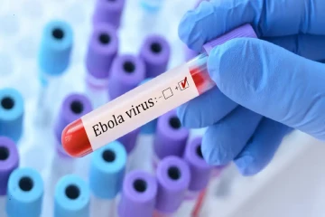 பிரான்ஸில் மருத்துவர் ஒருவருக்கு எபோலா வைரஸ்