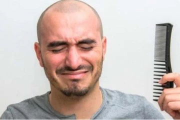 மொட்டை தலையிலும் முடி வளர வேண்டுமா? இதை மட்டும் செய்தாலே போதும்