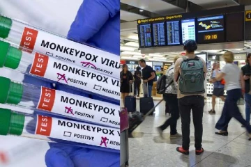 தொடர்ந்து அச்சுறுத்தும் குரங்கம்மை தொற்று: முதல் நாடாக கனடா விதித்த பயணக் கட்டுப்பாடு