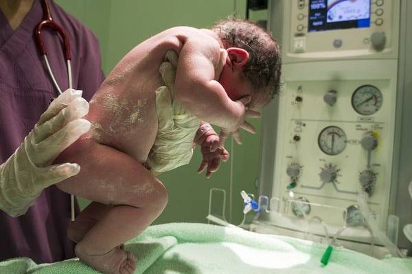 பிறந்தவுடன் ஏன் குழந்கைகள் அழுகின்றன தெரியுமா? இல்லாவிட்டால் என்ன நடக்கும்? | What Is The Purpose Of Babies Crying