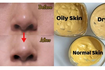 முல்தானி மெட்டி எதற்கெல்லாம் பயன்படுகிறது? எப்படி பயன்படுத்த வேண்டும்?