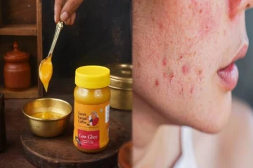 என்னது? பசு நெய்யை பயன்படுத்தி முகப்பருவை ஈசியா அகற்றிவிடலாமா!