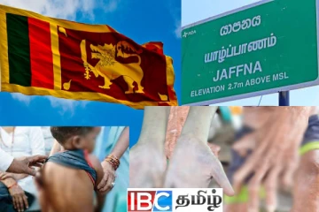 யாழ்ப்பாணம் உட்பட இலங்கையில் அதிகரிக்கும் தொழுநோய்