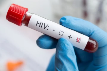 HIV ගැන ජාතික ඒඩ්ස් මර්දන ඒකකය කියූ දේ - පරික්ෂණය සිදු කරගන්නේ මෙහෙමයි..