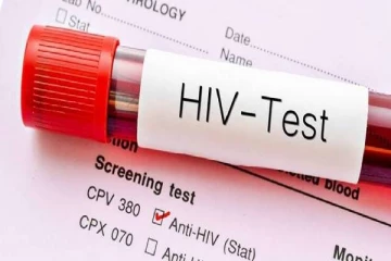 இலங்கையில் அதிகரித்து வரும் HIV நோயாளர்கள்