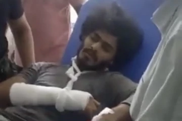 வருங்கால நடிகர் TTF வாசன் விபத்தில் சிக்கி கை உடைந்தது.. தற்போதைய நிலை என்ன தெரியுமா