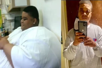 டாக்டர் சொன்ன ஒரே ஒரு வார்த்தையால்...! இப்படி இருந்த நான இப்படி ஆகிட்டேன்!