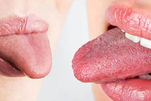 நாக்கில் இந்த அறிகுறிகள் இருக்கா? அப்போ இந்த ஆபத்து உறுதி | What Do Different Tongue Textures Mean