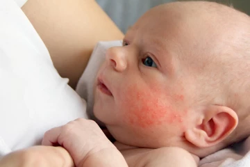 ළදරුවන් තුළ ඇති වන දද, පාලනය කළ හැකිද?