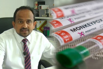 குரங்கம்மை நோய் குறித்து இலங்கை மக்களுக்கு விடுக்கப்பட்ட அறிவிப்பு!