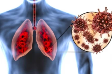 දිවයින පුරාම පැතිර යන, බෝවන රෝගයක් ගැන දැඩි අනතුරු ඇඟවීමක්..! රෝග ලක්ෂණ හා ගතයුතු ක්‍රියාමාර්ග මෙන්න ..