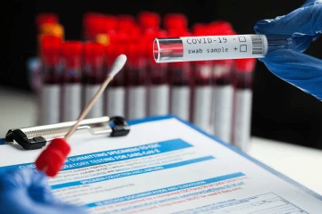 අද තවත් කොවිඩ් ආසාදිතයින් වාර්ථා වෙයි...