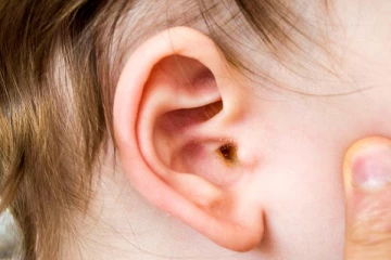 காதில் உள்ள அழுக்கை எப்படி எளியமுறையில் போக்கலாம்?