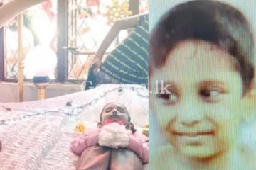 රෝහලෙන් දුන්න එන්නතින් මියගිය සය හැවිරිදි දරුවා.? (PHOTOS)