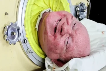 அமெரிக்காவின் இரும்பு நுரையீரல் மனிதன் உயிரிழந்தார்!