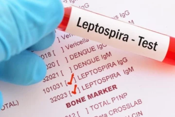 யாழ். மாவட்டத்தில் எலிக்காச்சலால் 99 பேர் பாதிப்பு; 6,000 பேருக்குத் தடுப்பு மருந்துகள்!