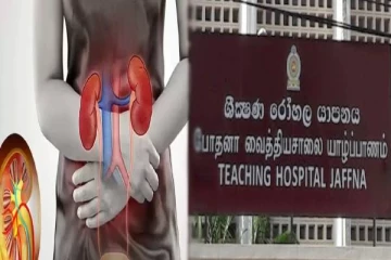 தாயாரது சிறுநீரகத்தை பிள்ளைக்கு மாற்றி அறுவைச் சிகிச்சை - யாழ். வைத்தியசாலை வரலாற்றுச் சாதனை!