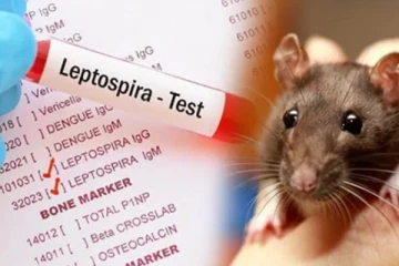 இலங்கையில் எலிக்காய்ச்சலினால் ஆயிரக்கணக்கானோர் பாதிப்பு