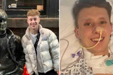 வெறும் காய்ச்சல் தான்... இரண்டு கால்களையும் இழக்க நேர்ந்த இளைஞர்