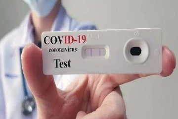 இலங்கைக்கு ரெபிட் அன்டிஜென் பரிசோதனை கருவிகள்