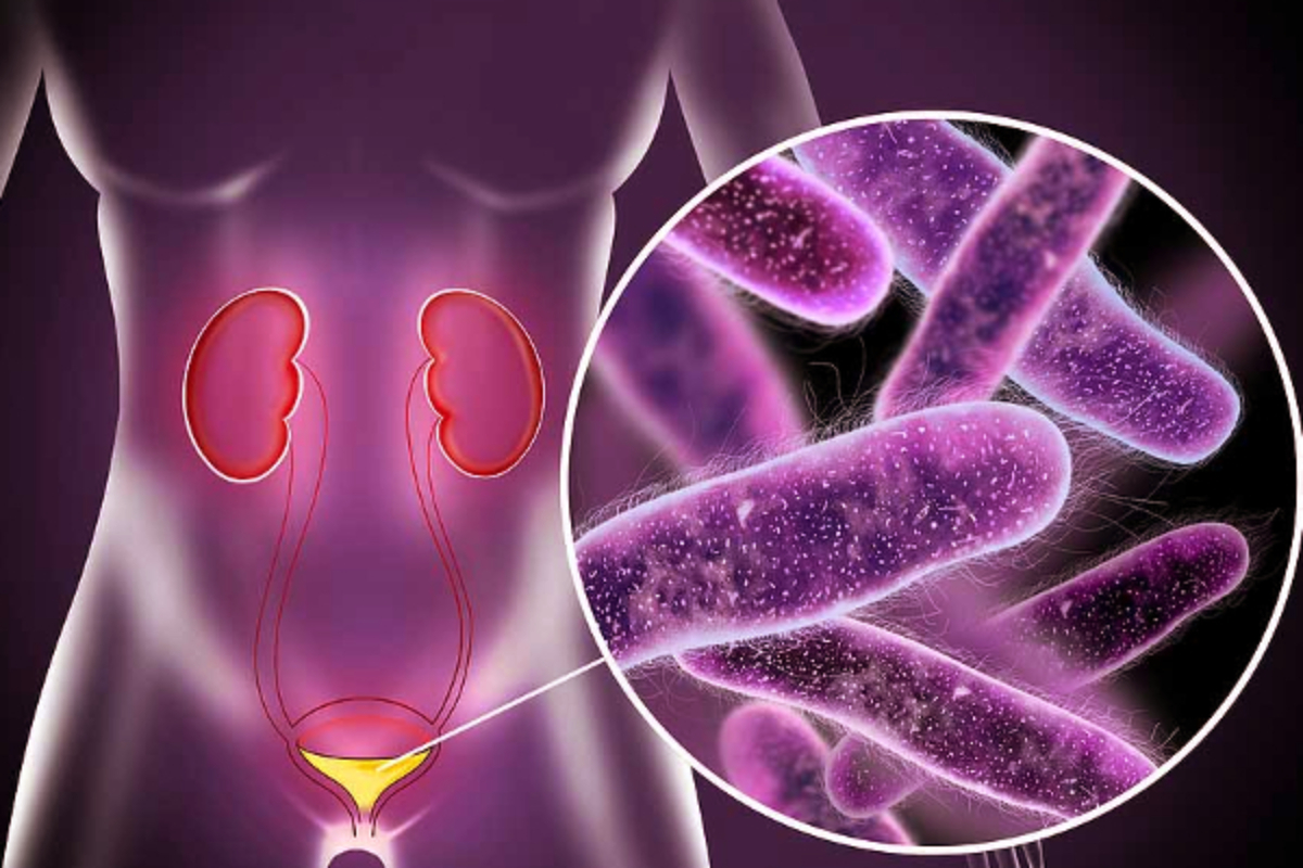 சிறுநீர் தொற்று ஏற்படாமல் எப்படி பாதுகாப்பது? | How To Prevent Urinary Tract Infections