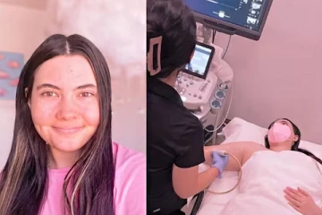 தண்ணீர் பட்டாலே உடம்பில் ஏற்படும் பாதிப்பு: அவதியுறும் இளம் பெண்