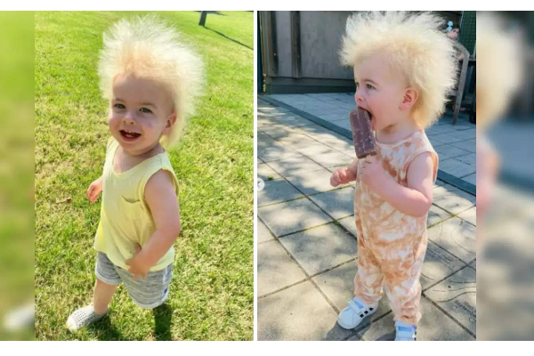 சீப்பு கொண்டு சீவினாலும் அடங்காத தலை முடி... அரிய வகை நோயால் பாதிக்கப்பட்ட சிறுமி! | World To Have Uncombable Hair Syndrome