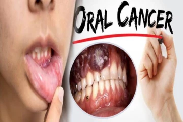 இந்த அறிகுறிகள் இருக்கா? அப்போ வாய் புற்றுநோய் அபாயம் உறுதி