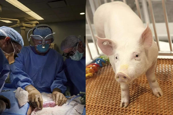 மனிதர்களுக்கு பன்றியின் சிறுநீரகங்கள் பொருந்துமா..! | Ny Successfully Transplant Pig Kidney Human