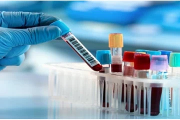 PCR பரிசோதனை முடிவுகள் கிடைப்பதில் தாமதம் - தனிமைப்படும் நாட்கள் குறைப்பு