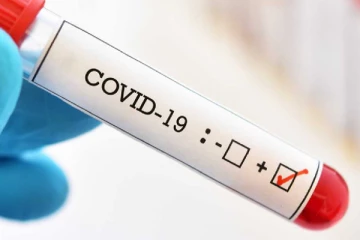 தமிழகத்தில் எகிறும் கொரோனா பாதிப்பு - பொதுமக்கள் அச்சம்