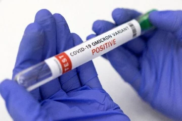 ஒமிக்ரோன் வைரஸ் இதில் இத்தனை நாட்கள் உயிர்வாழுமா?...வெளியான அதிர்ச்சி தகவல்