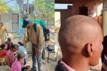 ஒரே வாரத்தில் வழுக்கை தலையான 3 கிராம மக்கள் - என்ன காரணம்?