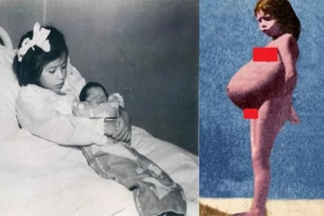 5 வயதில் ஆண் குழந்தைக்கு தாயாகிய சிறுமி - மருத்துவ உலகையே திருப்பி போட்ட சம்பவம்