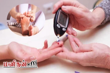 நீரிழிவு நோயின் அதிகரிப்பை கண்டுபிடிக்கணுமா? கை கால்களில் இந்த அறிகுறிகள் தோன்றும்