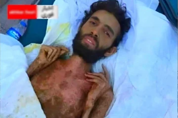 உலகை உலுக்கிய துருக்கி-சிரியா நிலநடுக்கம்: 3 மாதங்களுக்கு பிறகு உயிருடன் மீட்கப்பட்ட அதிசய மனிதன்