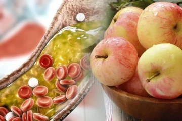 கெட்ட கொலஸ்ட்ராலை அடியோட நீக்கனுமா? இந்த 5 உணவுகள் எடுத்துகோங்க