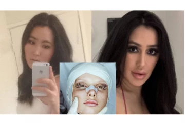 நடிகையாக மாற ஆசைப்பட்டு இளம் பெண் எடுத்த முடிவு! 15 அறுவை சிகிச்சைக்கு பின் எப்படி இருக்கிறார் தெரியுமா?