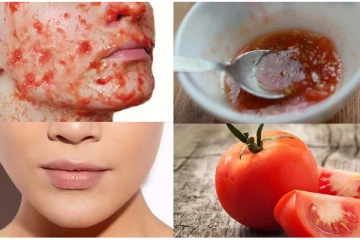 தக்காளி தினமும் சாப்பிடலாமா? முகம் வசீகரிக்க இப்படி பயன்படுத்துங்க