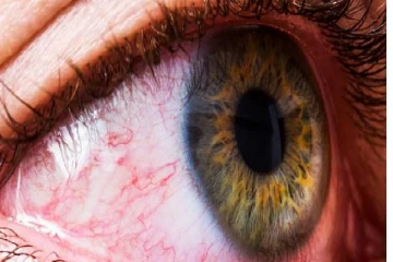 ஒமிக்ரோன் அறிகுறிகளை வெளிக்காட்டும் கண்கள்...அலட்சியம் வேண்டாம்!