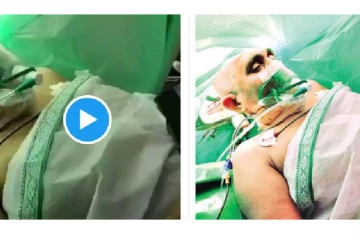 ஜூனியர் என்.டி.ஆரின் திரைப்படத்தை காண்பித்து, அறுவை சிகிச்சை செய்த மருத்துவர்கள்!