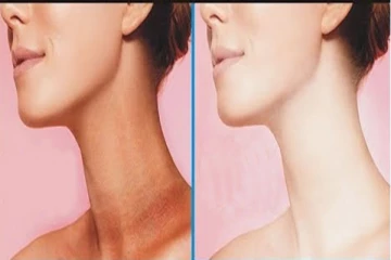 முகமும் கழுத்தும் வேறு வேறு நிறத்தில் இருக்கிறதா? இலகுவில் மாற ஈஸியான டிப்ஸ்